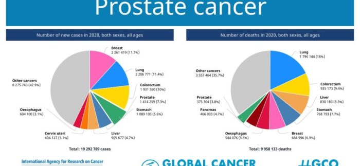 Which of the following statements is false regarding prostate cancer